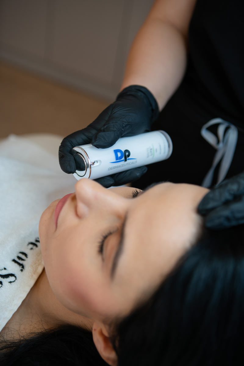 Dermapen Microneedling at House of Saab aesthetic clinic in Notting Hill, London