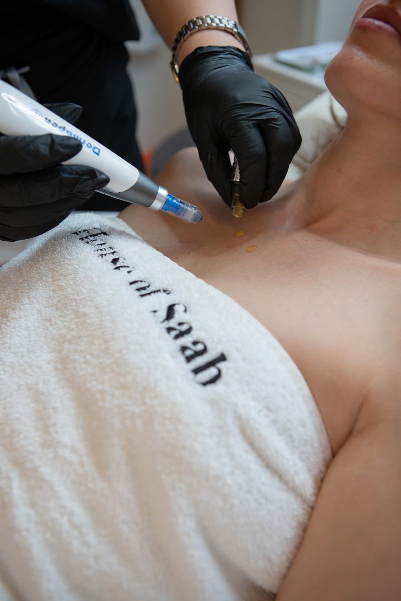 Dermapen Microneedling at House of Saab aesthetic clinic in Notting Hill, London